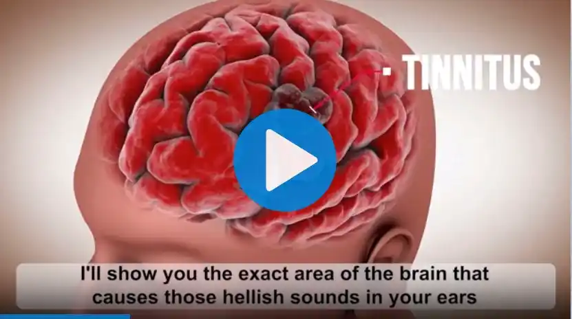 tinnitus-the-exact-area-of-the-brain